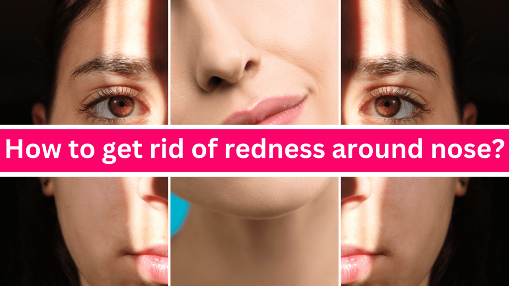 How to get rid of redness around nose?