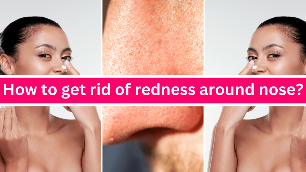 How To Get Rid Of Redness Around Nose 